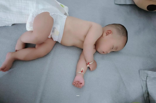 兴化宝宝脸上有白色斑块